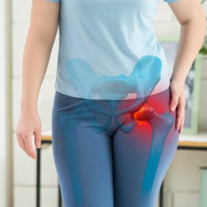 Guide pour prévenir et lutter contre l’arthrose